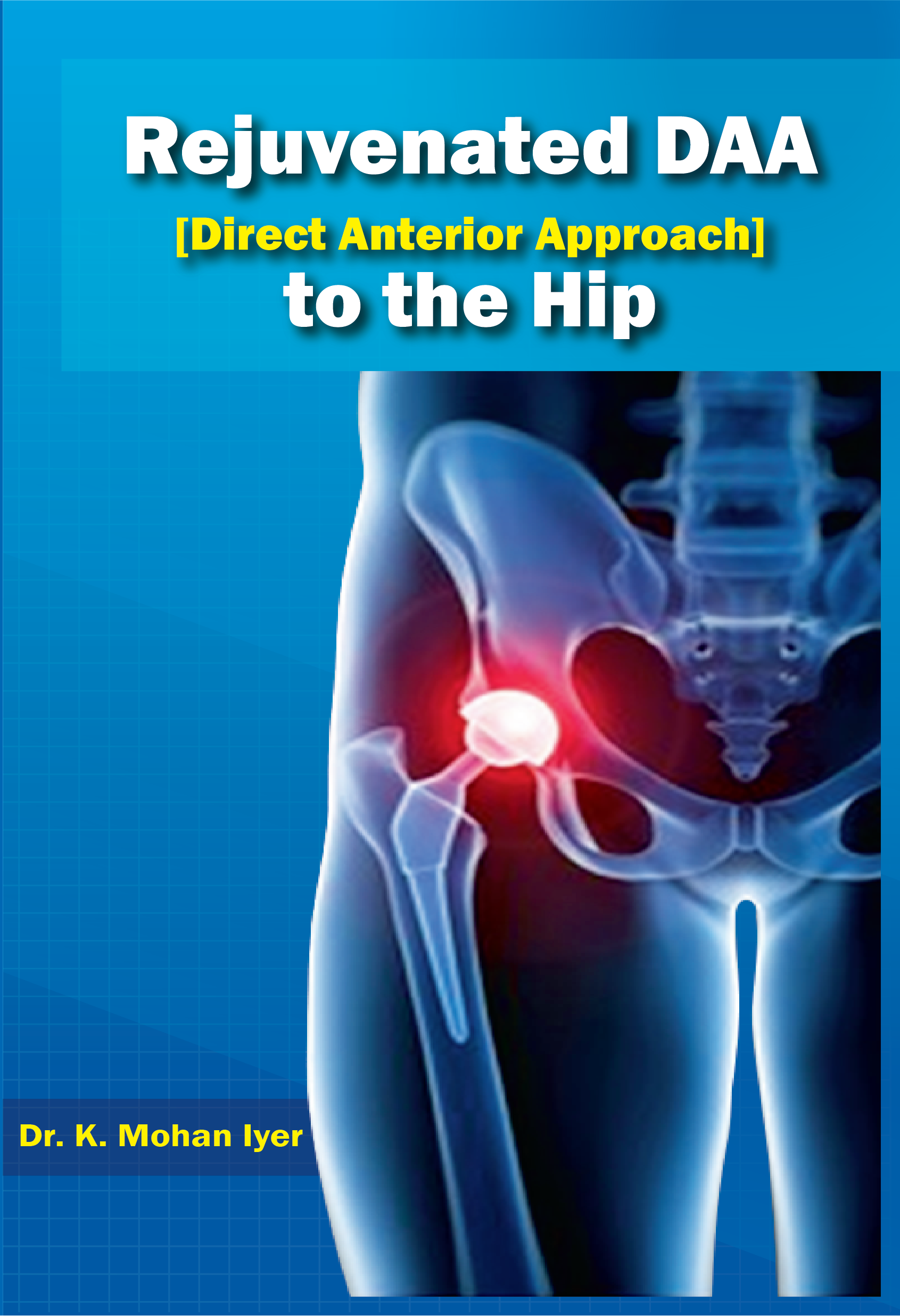 Rejuvenation of the DAA [Direct Anterior Approach] to the Hip Joint