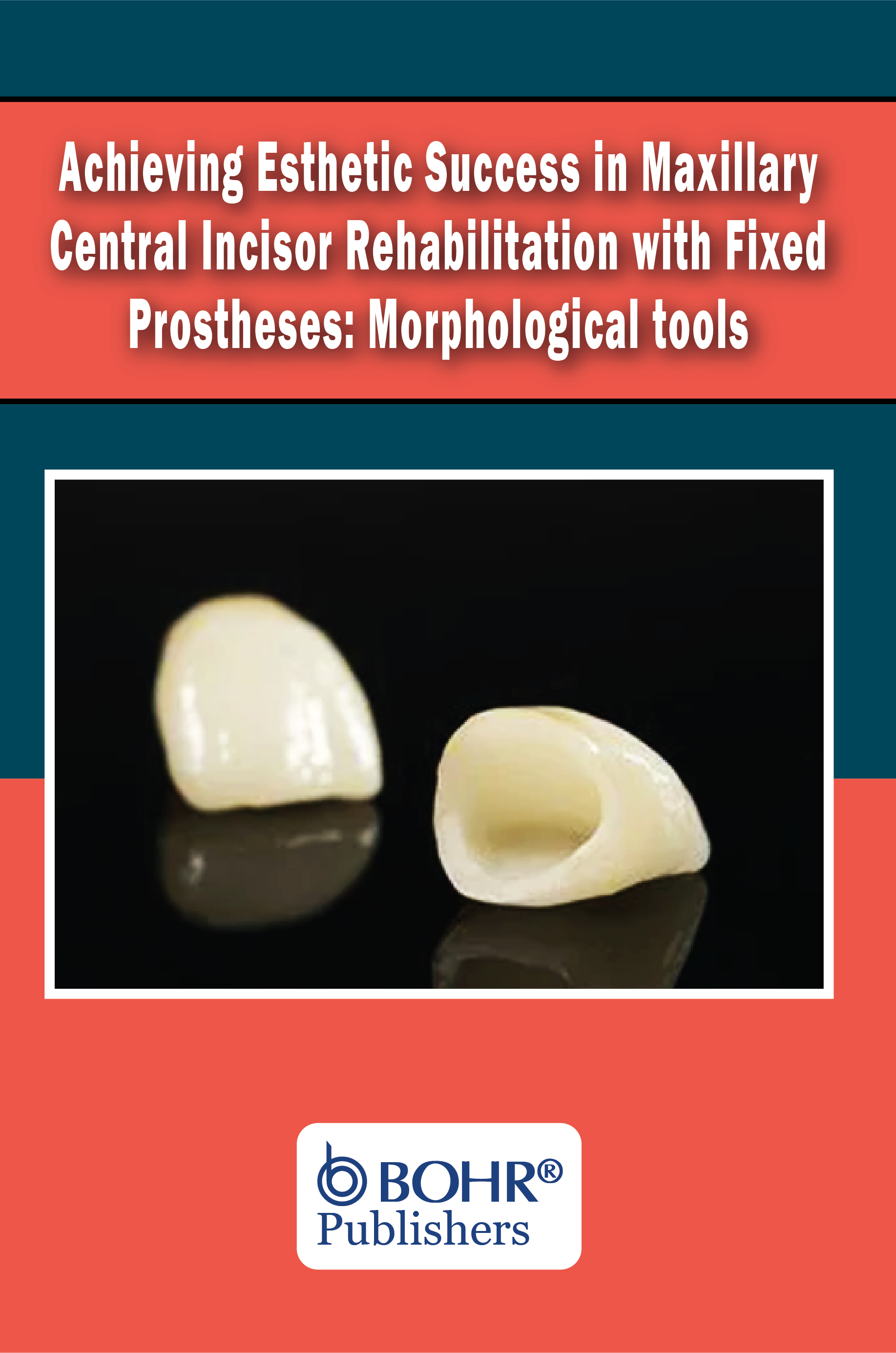 Fixed Prostheses: Morphological Tools