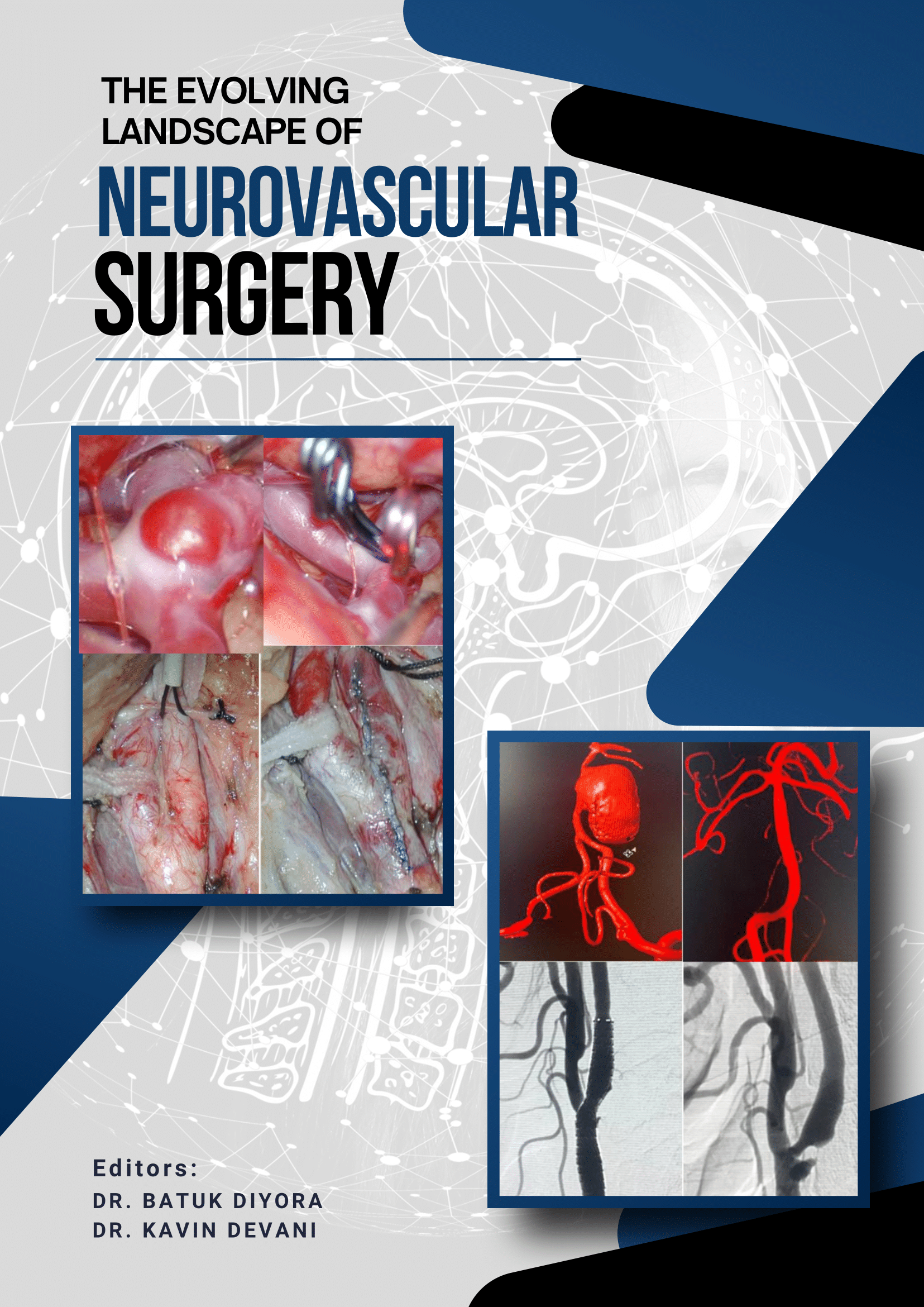 The Evolving Landscape of Neurovascular Surgery